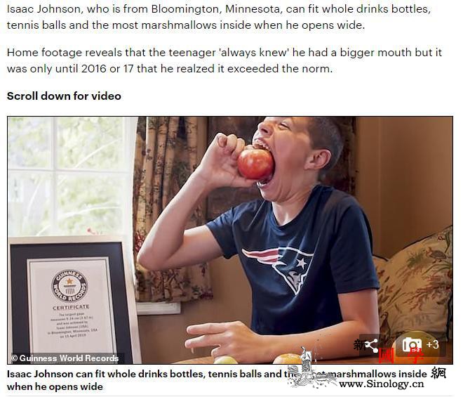 嘴巴可张10厘米这位14岁少年创吉尼_吉尼斯世界纪录-约翰逊-邮报-