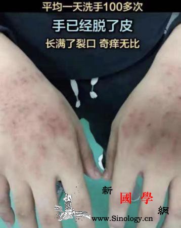 【全民阻击】心疼！没想到前方的你是这_宣城市-武汉-白衣战士-