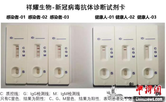 中国学者获得多株全人源抗体利用康复者_冠状-浙江大学-血浆-