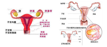 子宫内膜增厚是什么原因?_腺体-雌激素-增生-肿瘤-不孕不育