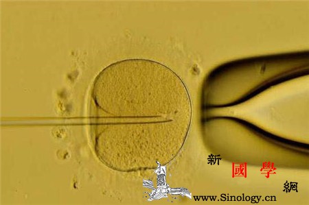 做试管婴儿要多少钱呢_卵泡-试管婴儿-胚胎-移植-不孕不育