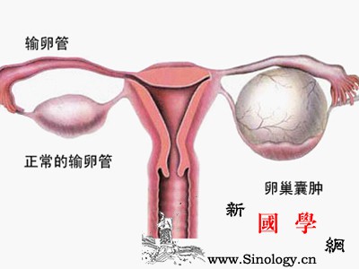 备孕这么久不成功小心卵巢囊肿来袭_囊肿-卵巢-肿瘤-怀孕-不孕不育