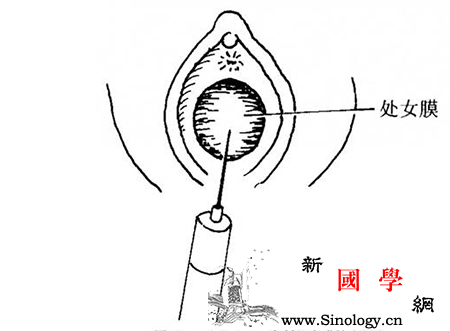处女膜片有多深手能碰到吗_膜片-处女膜-阴道-破裂-两性知识