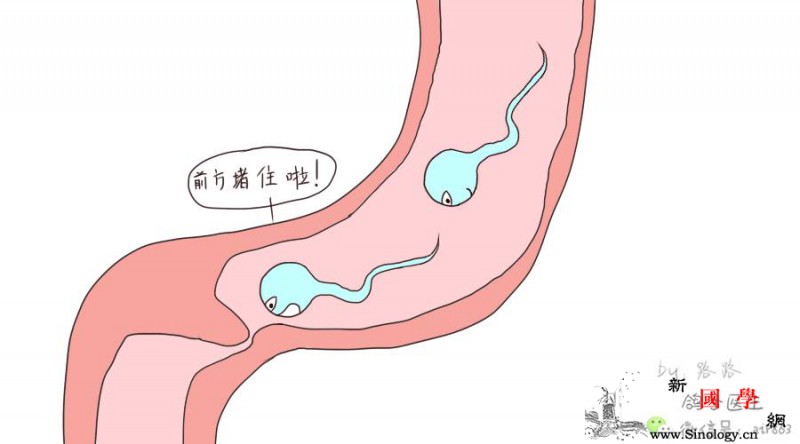 谁说生不出娃就都是女人的错！_输精管-精子-手段-男性-不孕不育