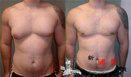 男性乳头痒是什么原因引起的_瘙痒-乳头-羞耻-乳腺-两性知识