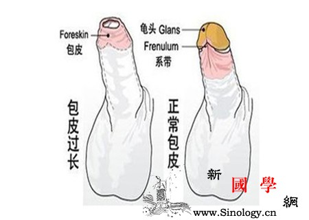 包茎手术最佳年龄_后天性-包茎-排尿-包皮-两性知识