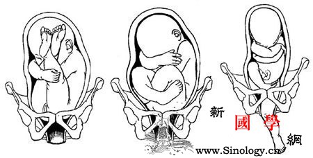 破水的原因有哪些_羊膜-胎膜-胎位-羊水-