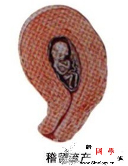 稽留流产是什么意思_稽留-母体-胚胎-妊娠-