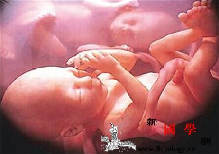 脐带脱垂的原因有哪些_胎膜-羊水-骨盆-脐带-