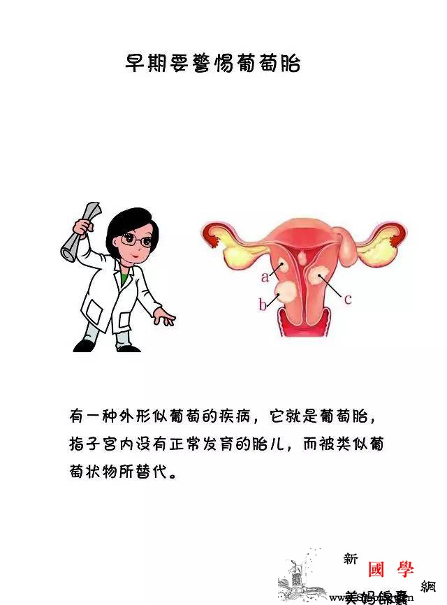 备孕二胎！小心是“葡萄胎”在作怪其症状有哪_葡萄胎-或者是-准妈妈-流产-孕前检查