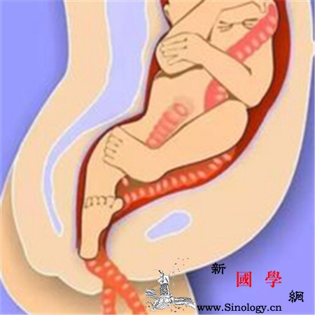 脐带脱垂的预防及护理_胎膜-羊水-脐带-产妇-