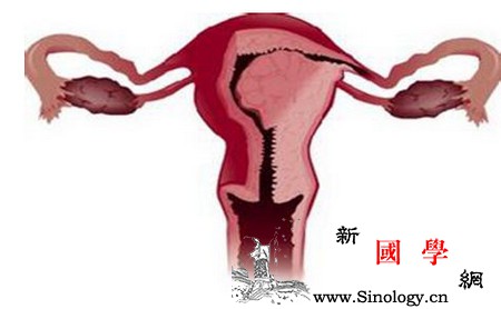 想受孕！该拿你怎么办薄薄的子宫内膜？_刮宫-雌激素-受孕-子宫内膜-怀孕准备