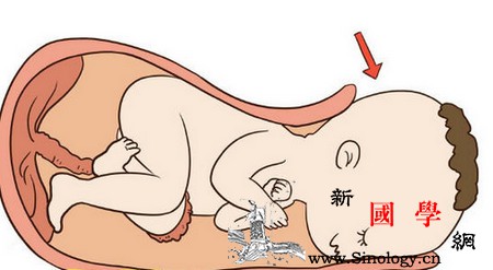分娩方式决定孩子未来顺产和剖腹产区别居然这_顺产-剖腹产-分娩-宝宝-