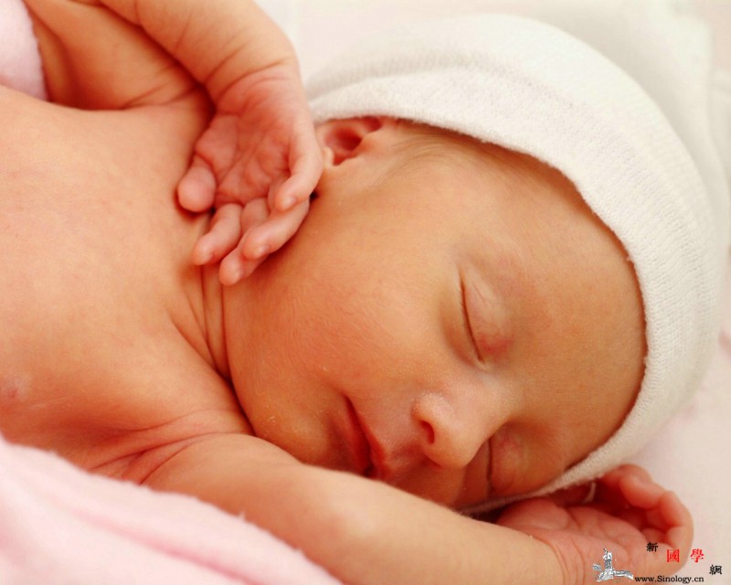 新生儿黄疸分类_足月-胆红素-早产儿-黄疸-