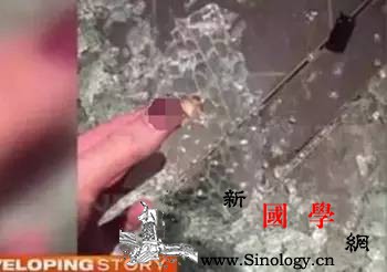 钢化玻璃自爆小男孩洗澡时被炸伤_边边角角-澳洲-钢化玻璃-浴室-