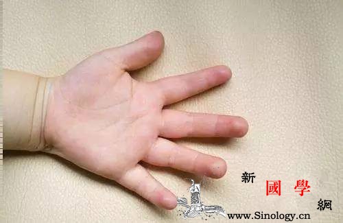 紧急提醒！路上的这个东西太危险多名孩子已受_排气管-烫伤-浩浩-孩子-