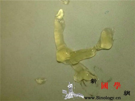 精子果冻状正常么_精囊-精液-精子-果冻-两性知识