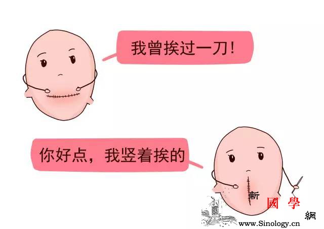 一胎剖了二胎怎么办啊？_瘢痕-胎盘-凶险-胚胎-
