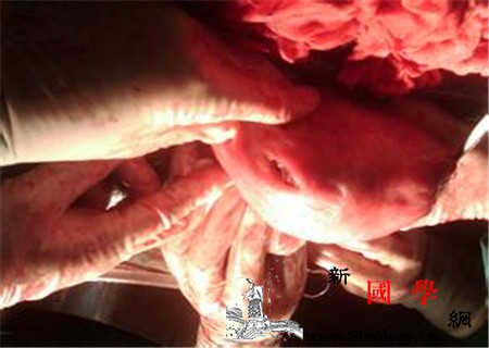 刮宫后出血多久_刮宫-术后-子宫-蛋白质-