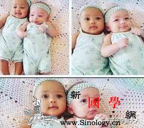 你的这些特征100%都会遗传给你家娃！不然就_秃顶-遗传-子女-父母-遗传优生