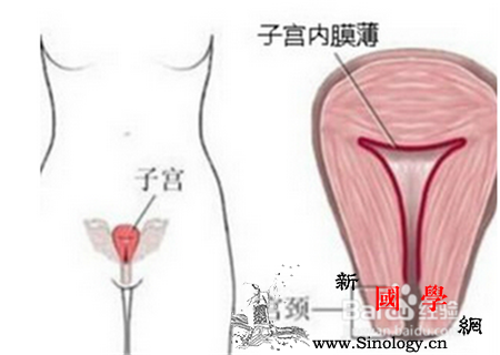 刮宫后子宫多久能恢复_刮宫-适用于-红糖-补血-