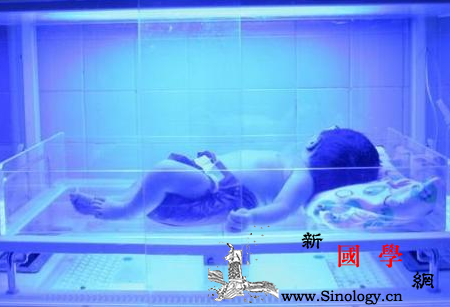 新生儿黄疸蓝光治疗_光疗-胆红素-黄疸-喂奶-