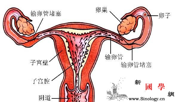 输卵管堵塞影响不孕不育做试管婴儿需注意_试管婴儿-梗阻-输卵管-精子-不孕不育