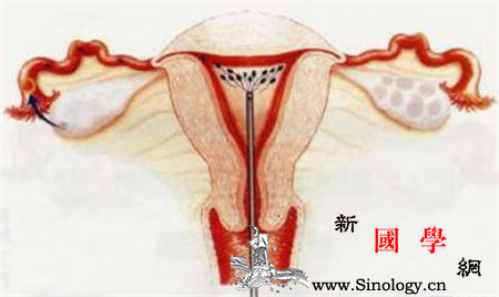 输卵管疏通怎么做_输卵管-怎么做-疏通-术后-怀孕准备