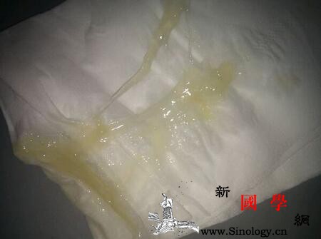 宫颈粘液栓流出多久会生_粘液-卵子-周期性-宫颈-