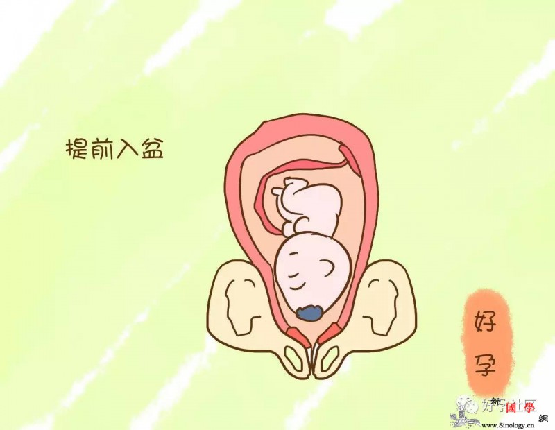 当医生告诉你胎儿半入盆时这些活动就要开始了_骨盆-什么时候-胎儿-散步-