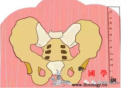 分娩是否顺利？了解骨盆关键数据很重要！_骶骨-骨盆-分娩-髂骨-