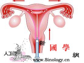 人工授精or试管婴儿应该如何选择？_试管婴儿-卵子-精液-胚胎-不孕不育