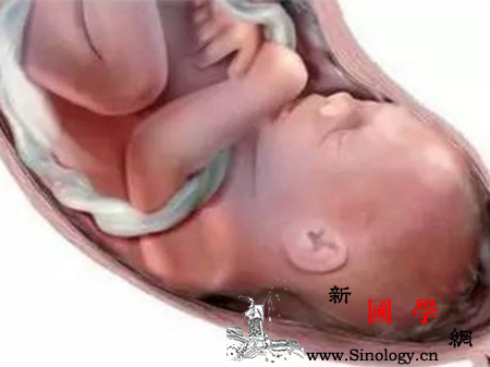 羊水少脐带绕颈一周能顺产吗_胎位-顺产-胎动-羊水-