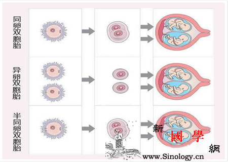 同卵双胞胎发育过程图_长出-受精卵-双胞胎-妈妈-遗传优生
