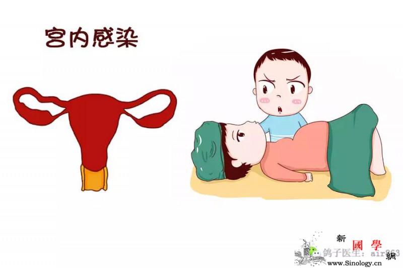 分娩过程中我们遇到这4种意外需要剖腹产！_胎位-顺产-剖腹产-宫内-