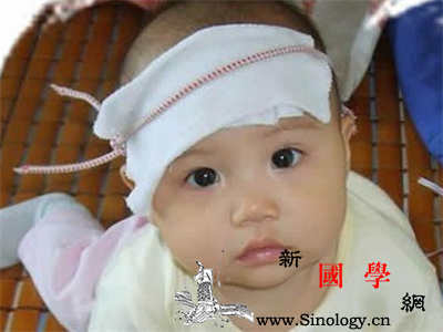 新生儿湿疹如何处理？_冷敷-患处-乳汁-湿疹-