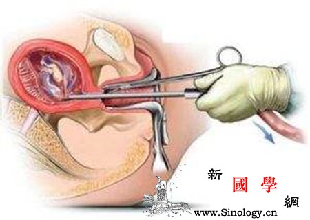 可视无痛人流术前注意什么_超导-无痛-妊娠-孕妇-