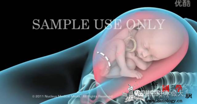 剖腹产对胎儿有3大伤害对产妇有4大伤害准_产道-剖腹产-产妇-剖宫产-