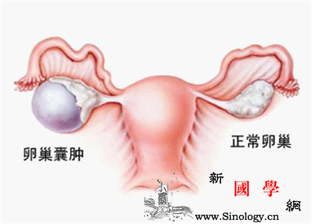 卵巢囊肿是怎么引起的_酸化-卵巢-细胞-因素-怀孕准备
