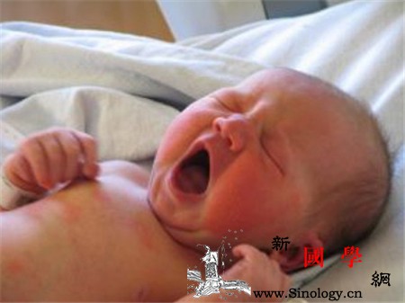 新生儿哭声如猫叫警惕败血症_败血症-黄疸-抗菌-药物-