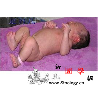 正常足月儿的定义_热卡-足月-需要量-血红蛋白-