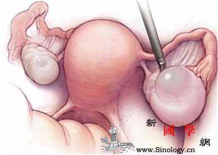畸胎瘤是怎么形成的_胚层-囊肿-胚胎-胎儿-