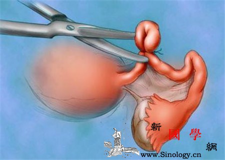 畸胎瘤对身体的危害有哪些_网膜-卵巢-肿瘤-危害-