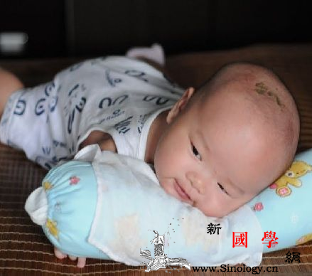 足月新生儿黄疸值多少可出院_巩膜-足月-黄疸-相关文章-