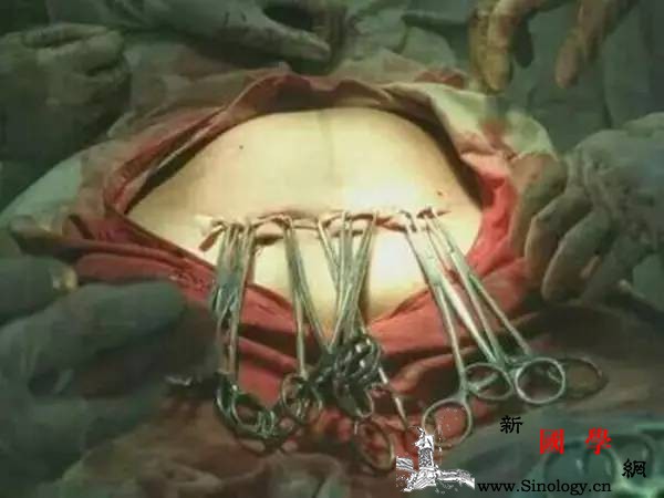 剖腹产疼还是顺产更疼听听生过宝宝的妈妈们是_会有-顺产-临产-麻药-