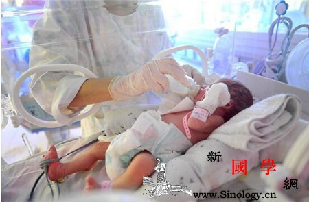 双胞胎剖腹产多少钱_剖腹产-双胞胎-准妈妈-怀孕-