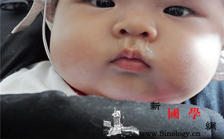 新生儿秋季流鼻涕怎么办_鼻塞-鼻涕-秋季-感冒- ()