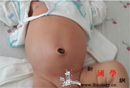 新生儿肚子大正常吗_腹胀-消化道-喂奶-阻塞-