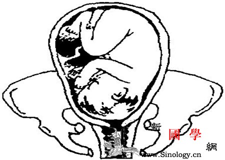 开宫口要多久不是你以为的那么容易快速哦_经产妇-初产妇-潜伏期-宫颈-