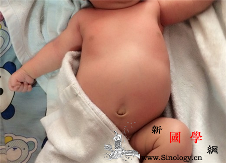 新生儿肚子发亮是怎么回事_结肠-腹胀-喂奶-呕吐-